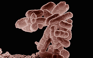 Plaga zakażeń bakteriami coli na Warmii i Mazurach